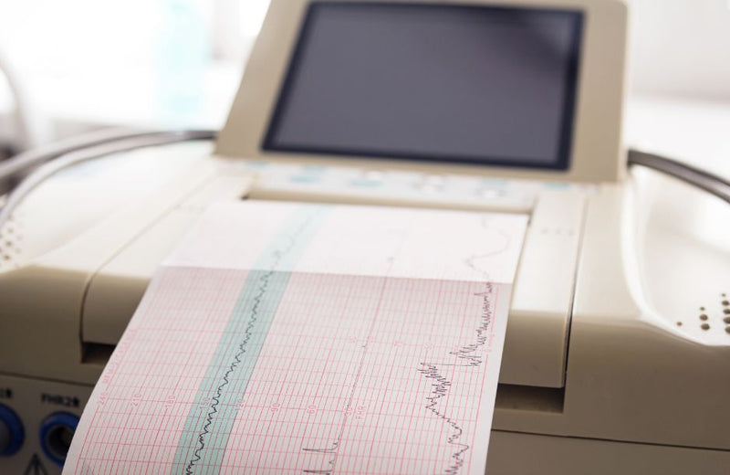 Everything You Should Know About Using EKG Machines