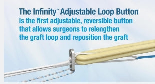 CONMED KFB035 INFINITY FEMORAL ADJUSTABLE LOOP BUTTON